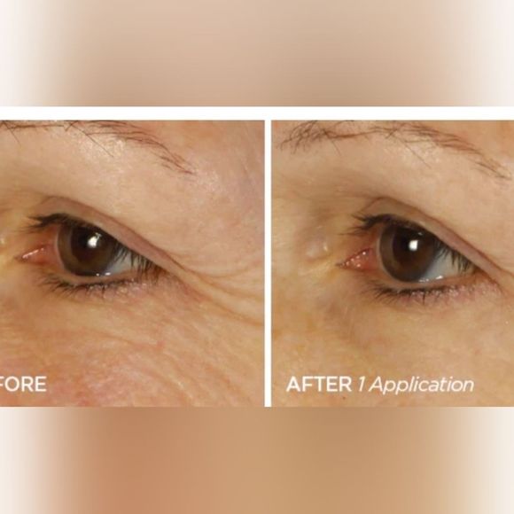 BeautyBio Bright Eyes DePuffing & Brightening Eye Gels- 15PK - Picture 4 of 9